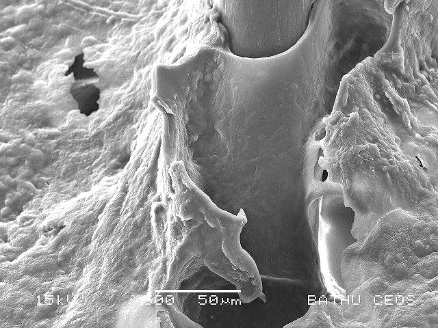 Как выглядит перхоть под микроскопом