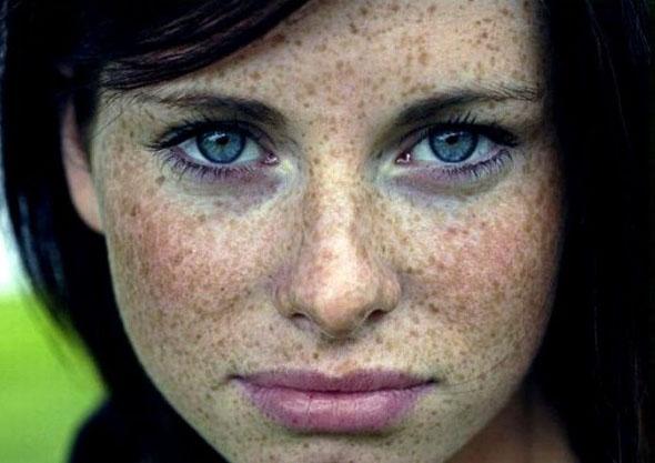 Что такое фотостарение кожи