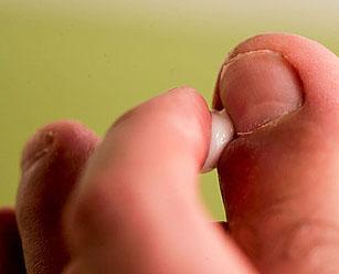 Комплексное лечение грибка ногтей — Грибок Ногтей
